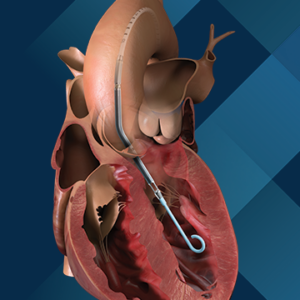 Impella heart pumps