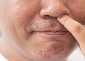 Alzheimer's disease