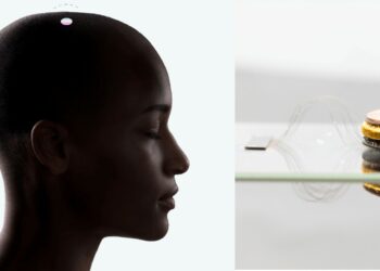 Elon Musk Reveals Neuralink's First Patient Update: A Milestone in Brain-Computer Interface Technology