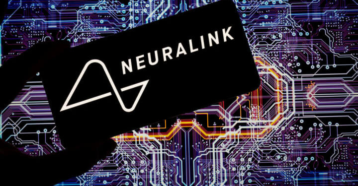 Elon Musk Neuralink’s first human trial faces setback.
