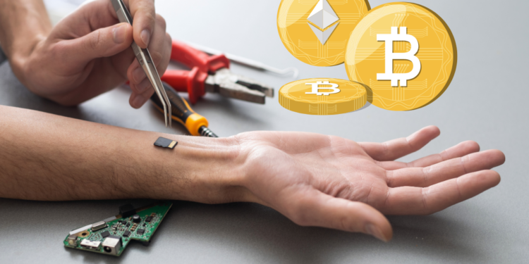 Implantable Wallets: The Convergence of Cryptocurrency and Biohacking
