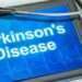 Parkinson's Symptoms Reduced by AI-Powered Treatment