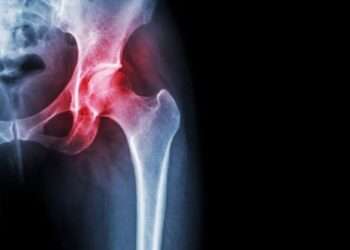 Stanford Researchers Discover Potential Way to Regrow Knee Cartilage by Blocking Aging-Related Protein